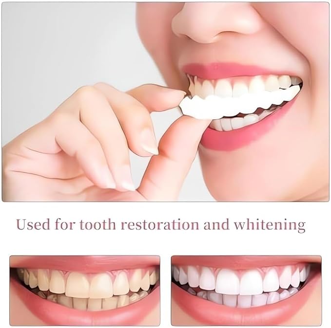 SMYL Silicone Teeth – 2 Upper & 2 Lower Pairs