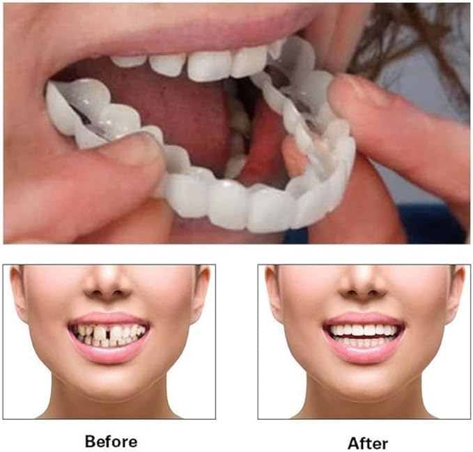 SMYL Silicone Teeth – 2 Upper & 2 Lower Pairs